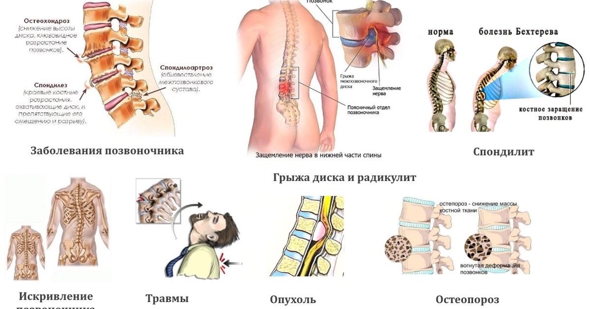скованность тела причины