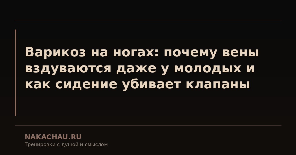 варикоз на ногах